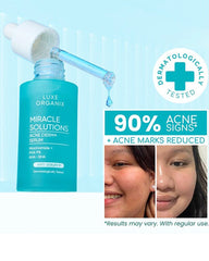 Luxe Organix Miracle Solutions Acne Derm+ Serum showing acne marks reduction benefit