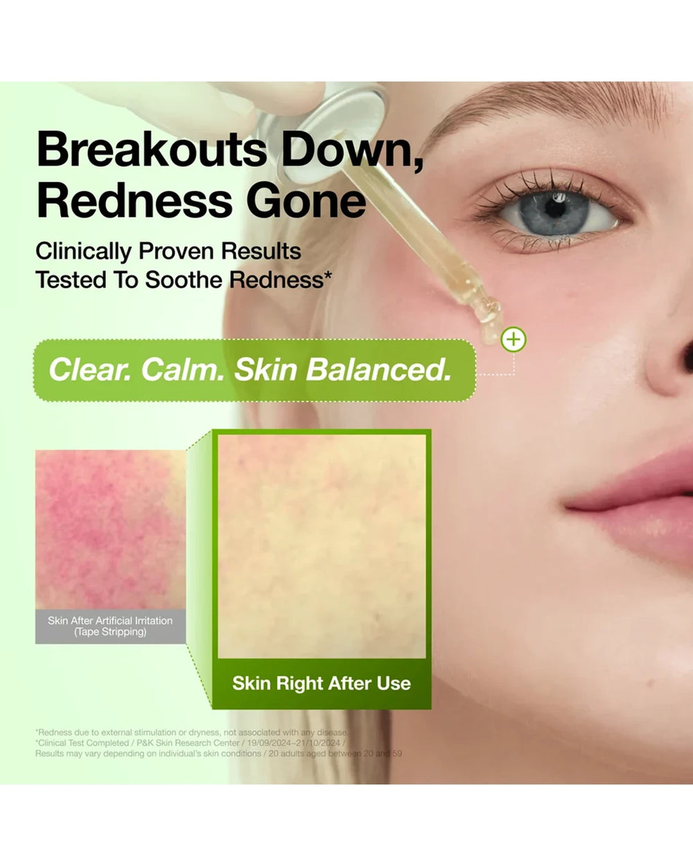 Anua Azelaic Acid Serum clinically tested to soothe visible redness caused by external irritation or dryness
