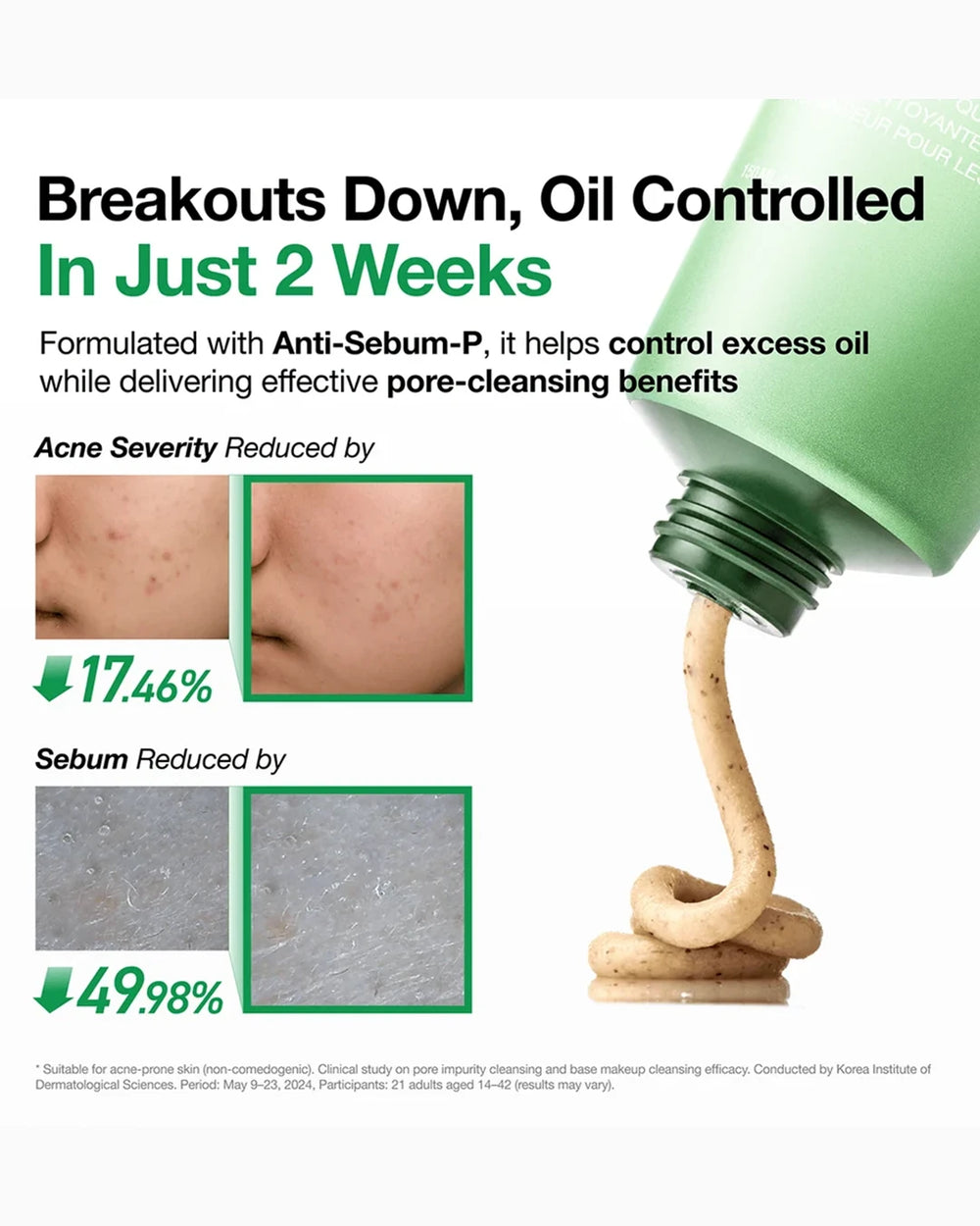 Anua Heartleaf cleansing foam sebum control and blemish care test results