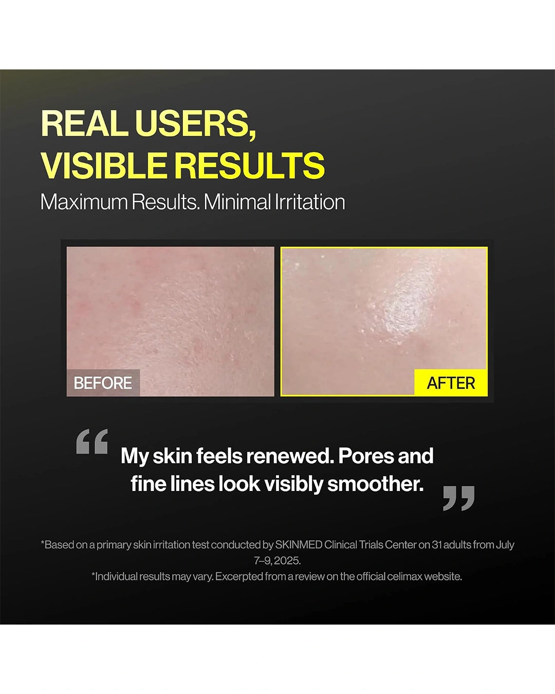 Before and after skin comparison for Celimax Retinal Shot Tightening Booster showing the appearance of smoother texture and less visible pores