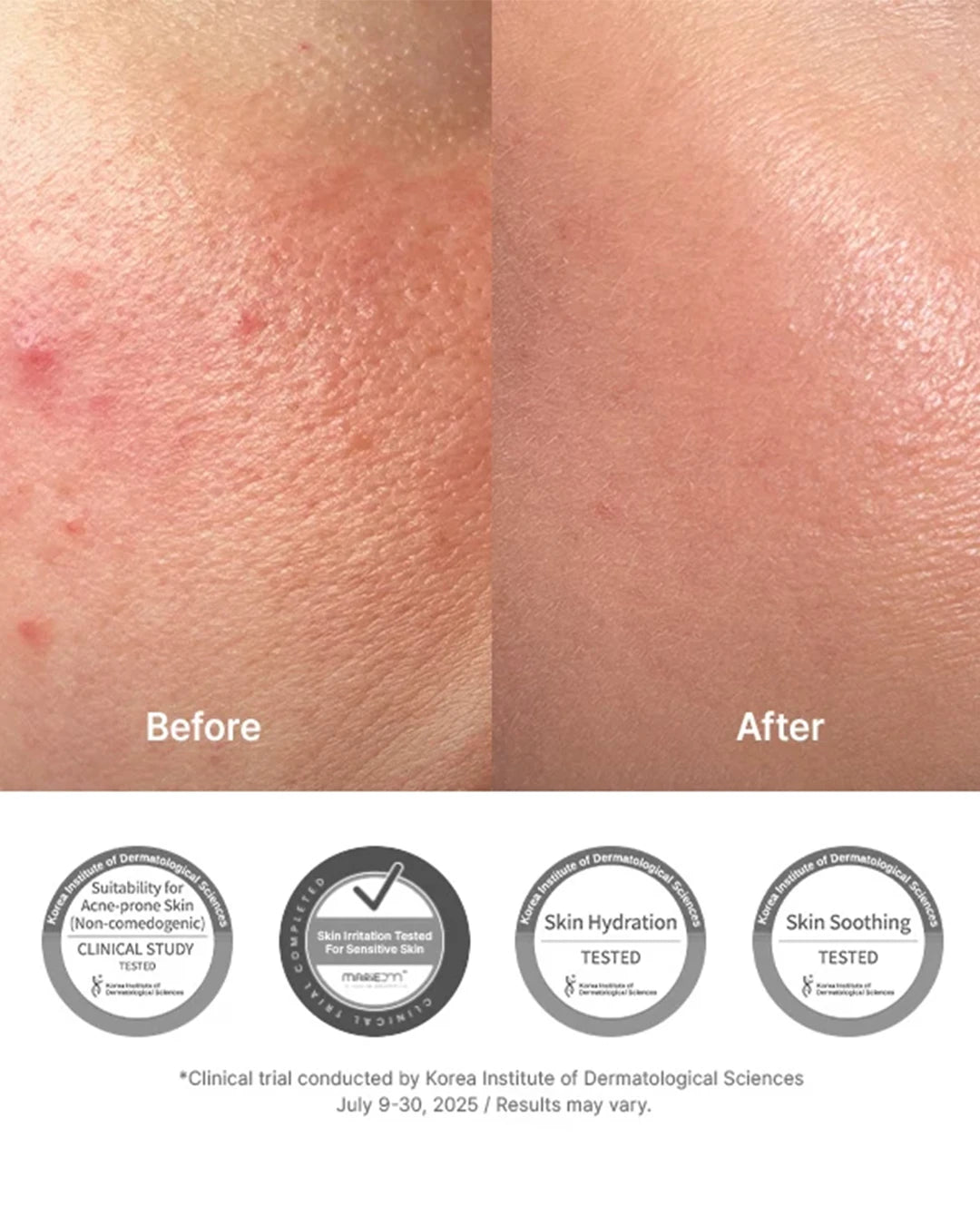 Dr. Althea 345 Relief Cream hydrating moisturizer for skin barrier support