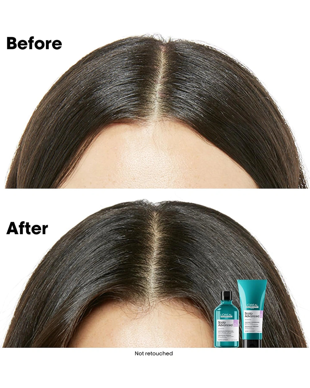 Before and after hair appearance comparison promoting L'Oréal Professionnel Scalp Advanced anti-discomfort care routine