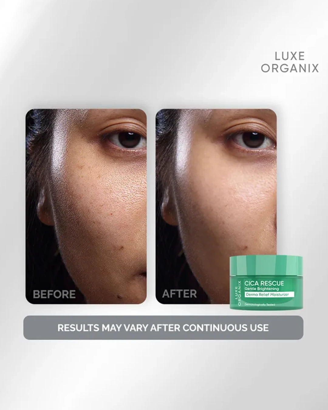 Luxe Organix Cica Rescue moisturizer skincare results and soothing hydration benefits