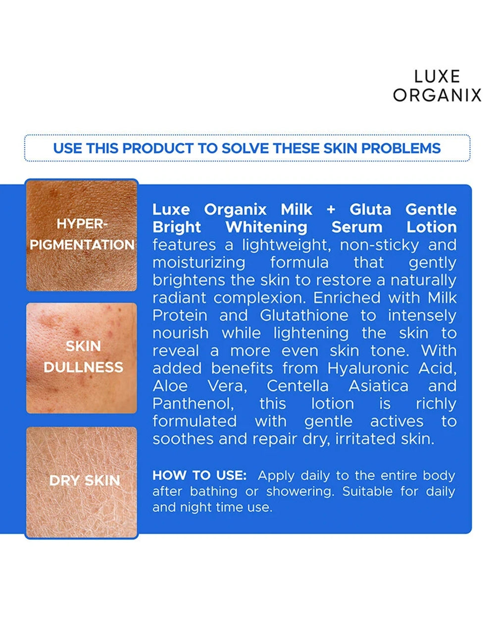 Luxe Organix Milk + Gluta Gentle Bright serum body lotion infographic showing hydration dull skin care and uneven skin tone benefits