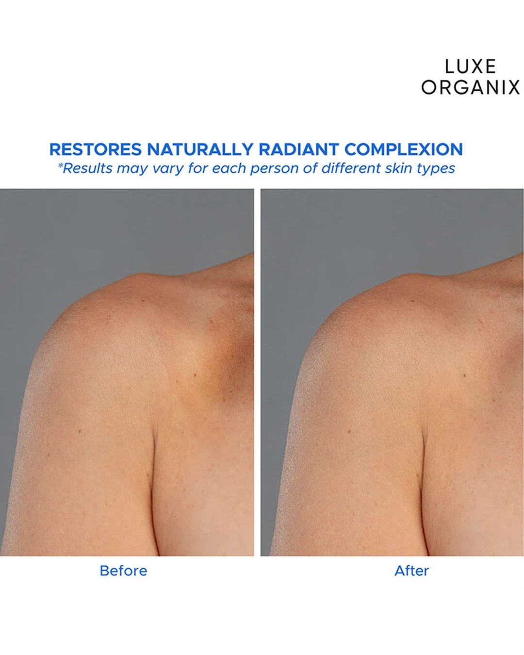 Luxe Organix Milk + Gluta serum body lotion 350ml promotional before and after skin comparison highlighting a smoother brighter looking complexion
