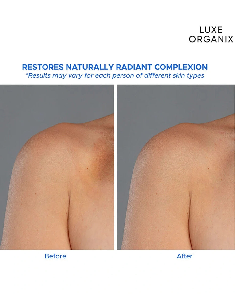 Luxe Organix Milk + Gluta serum body lotion 350ml promotional before and after skin comparison highlighting a smoother brighter looking complexion