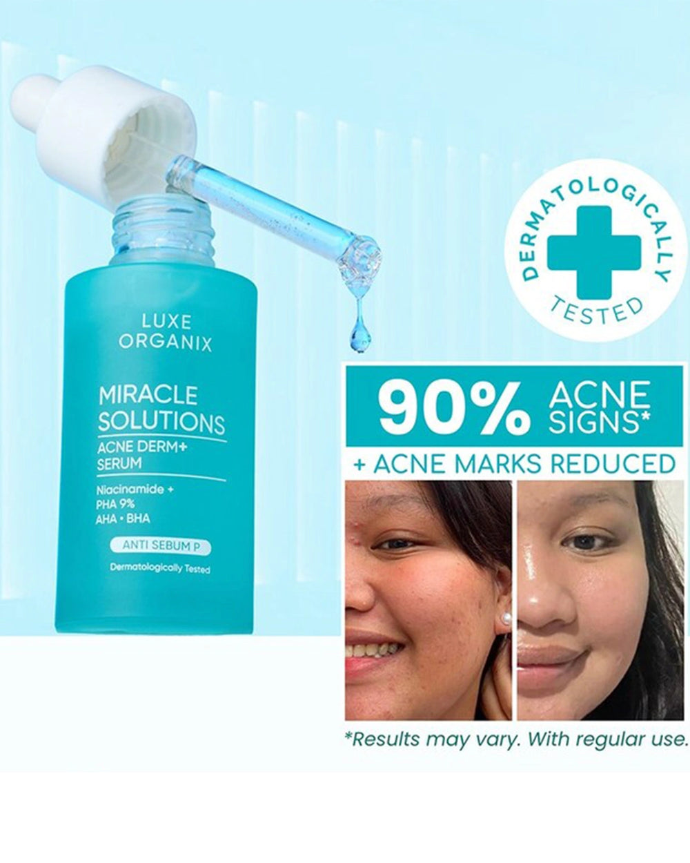 Luxe Organix Miracle Solutions Acne Derm+ Serum showing acne marks reduction benefit