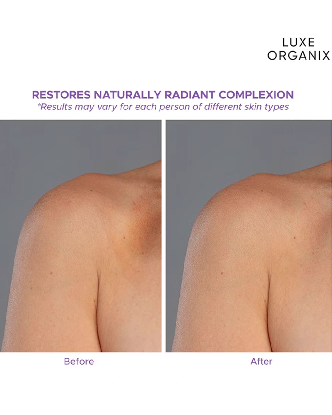 Before and after comparison graphic for Luxe Organix Retinol + Gluta Body Lotion showing the appearance of skin radiance and tone
