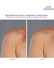 Before and after comparison graphic for Luxe Organix Retinol + Gluta Body Lotion showing the appearance of skin radiance and tone