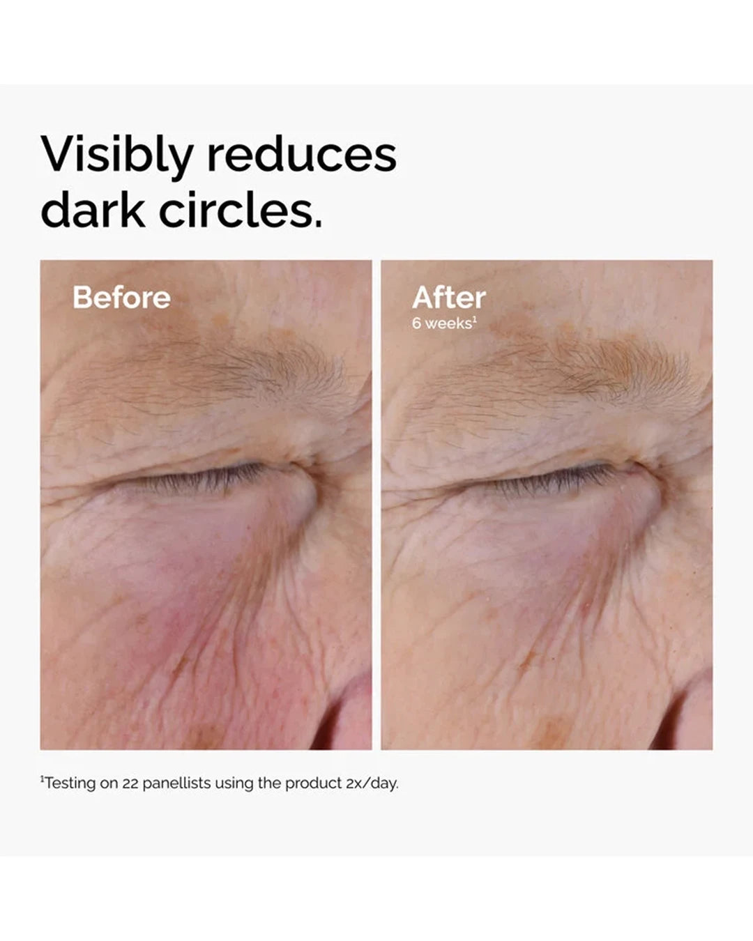 The Ordinary Caffeine Solution 5% + EGCG visibly reduces dark circles with continued twice-daily use